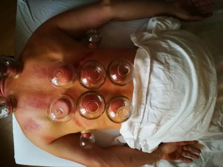 Tuina Paxis Workshop TCM Nov `17